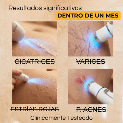 Fototerapia BioLuz Control ®