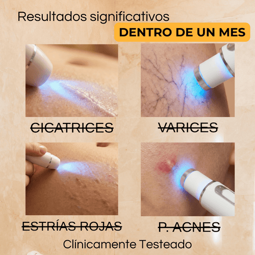 Fototerapia BioLuz Control ®