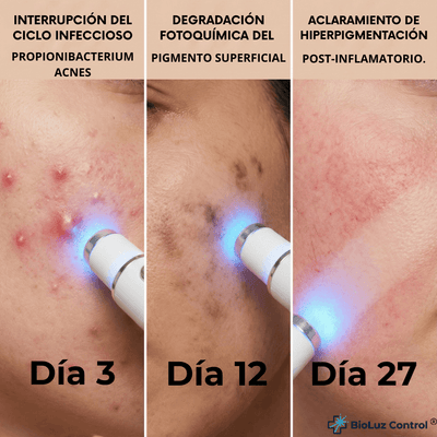 Fototerapia BioLuz Control ®